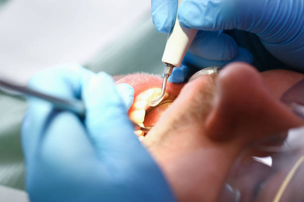 Best Urgent Dental Care for Toothache in Murphysboro, IL