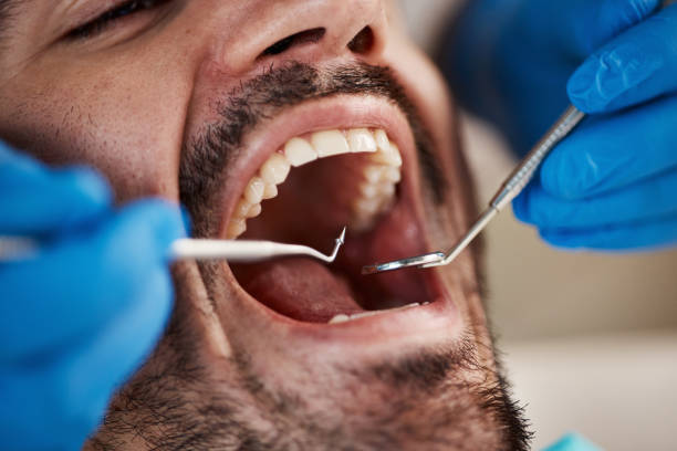 Best Emergency Dentist for Knocked-Out Tooth in Murphysboro, IL