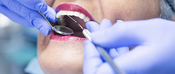 Best Emergency Root Canal Treatment in Murphysboro, IL